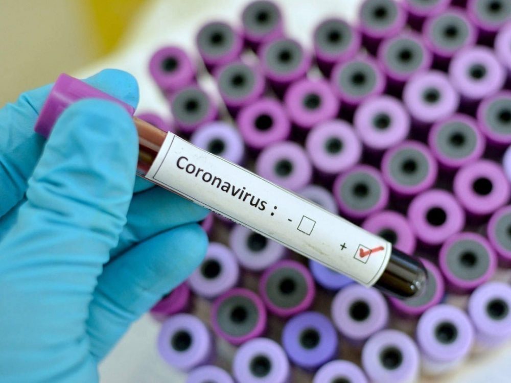 Для розробки вакцини від коронавірусу зібрали 7,4 млрд євро – Єврокомісія