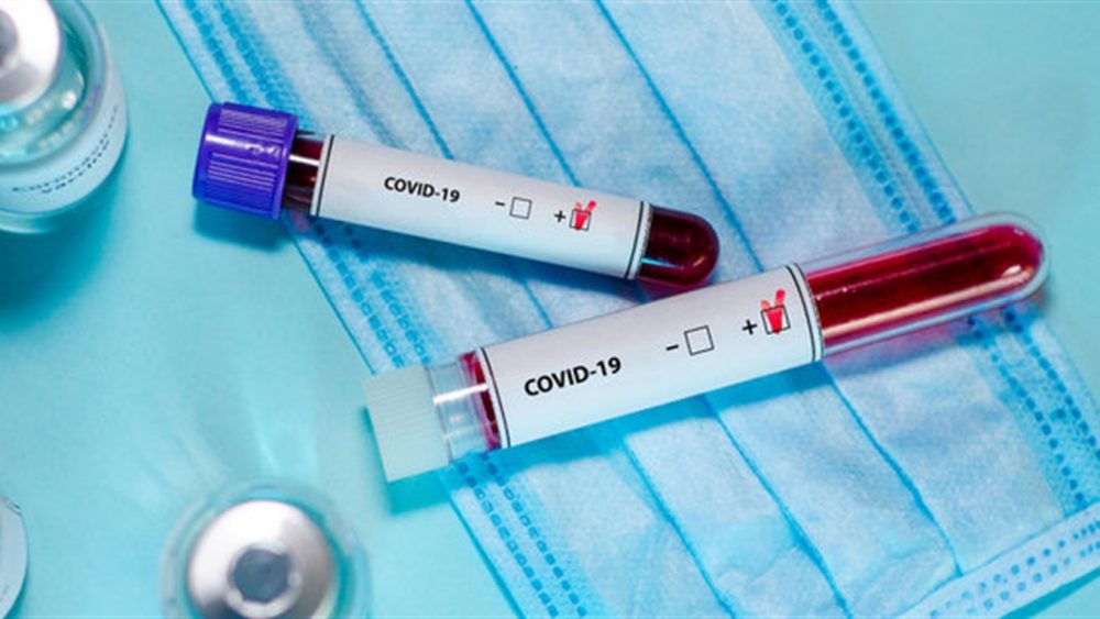 Антирекорд коронавірусу в Україні: за добу 758 випадків захворювання, 31 людина померла